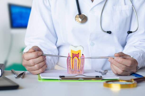 Best Emergency Root Canal Therapy in Oswego, NY