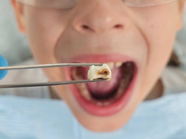 Best Emergency Pediatric Dental Care in Oswego, NY